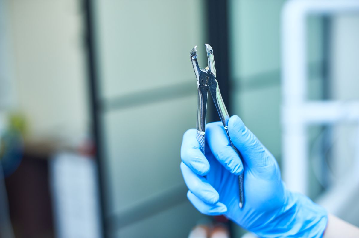 Tooth Extractions