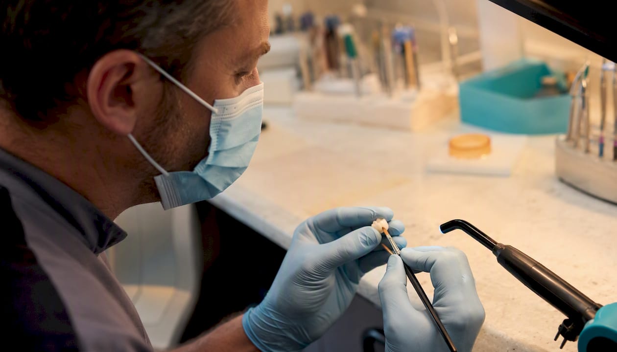 Dentist applying composite resin to crown chip