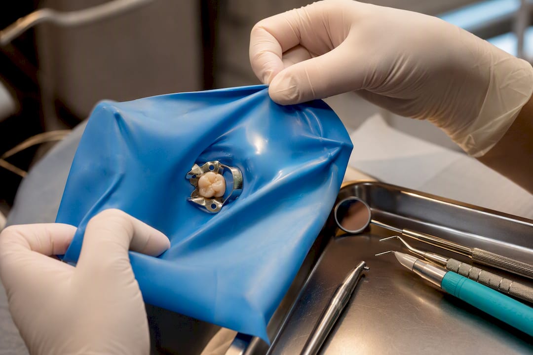 Rubber dam isolating tooth during filling