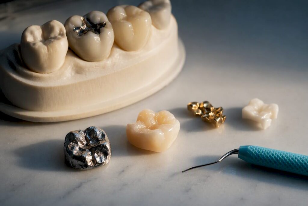 Dental filling materials beside tooth model