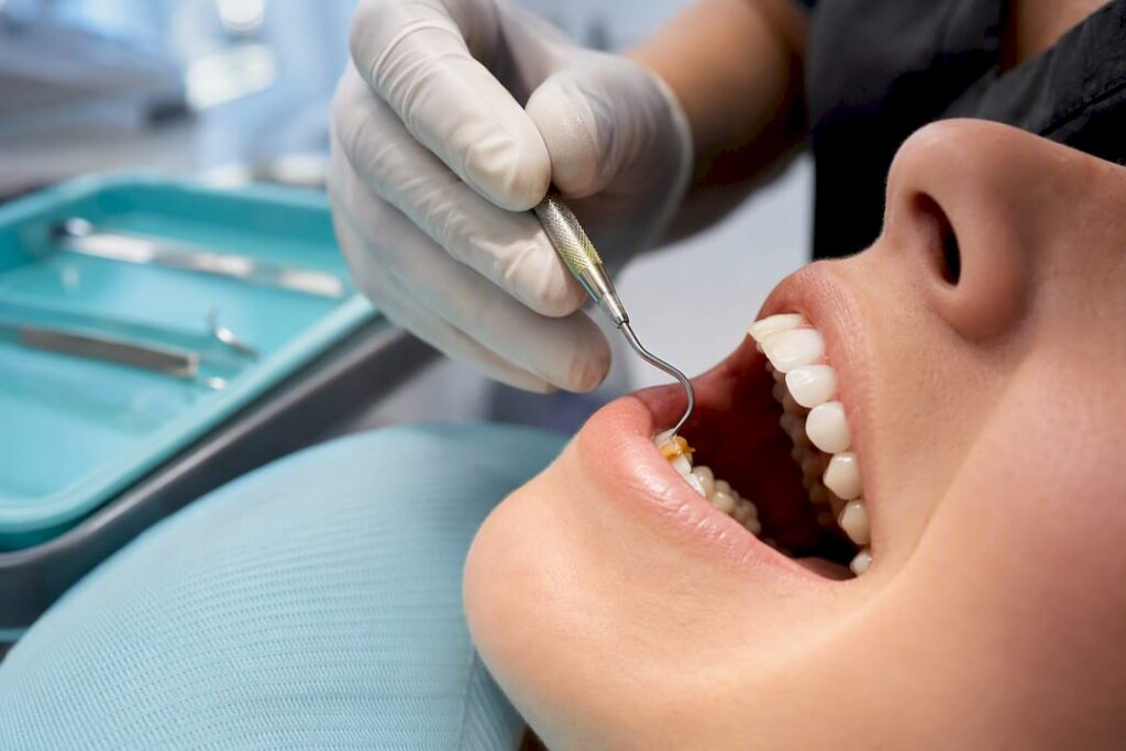 Dentist removing popcorn hull from gums