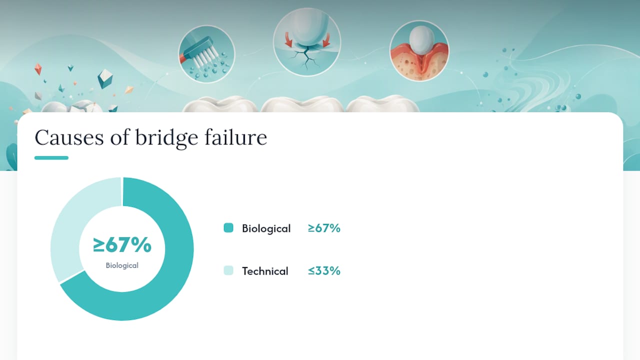 Why Do Dental Bridges Actually Fail? — overview diagram