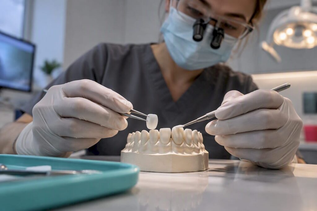 Porcelain and composite veneer materials compared