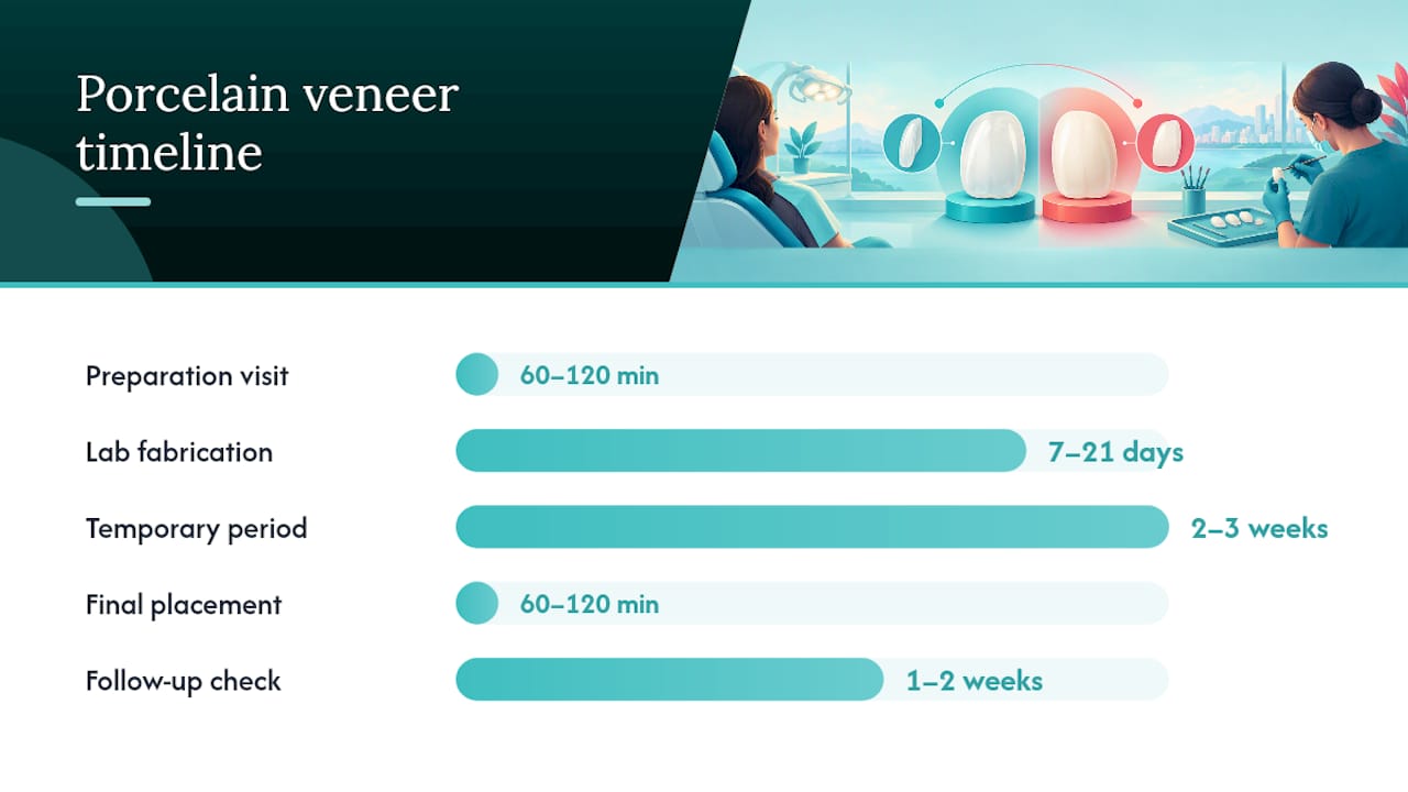 Porcelain veneers: step-by-step timeline and realistic time windows — overview diagram